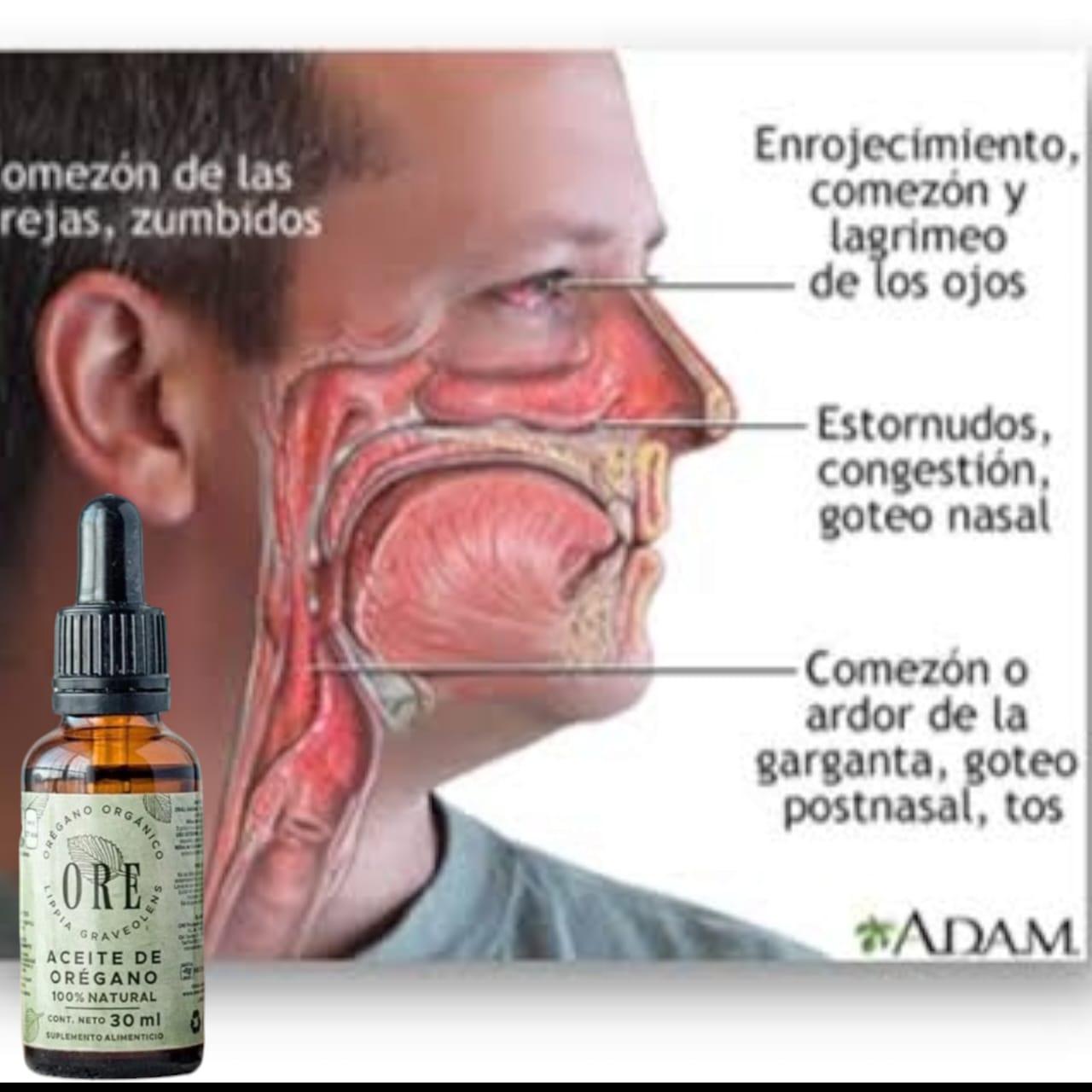 ACEITE DE OREGANO ORE ™ ⭐⭐⭐⭐⭐ ELIMINA LA SINUSITIS, ALERGIAS, RINITIS Y HONGO CANDIDA