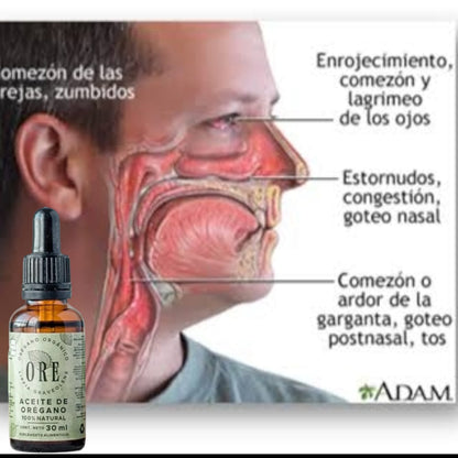ACEITE DE OREGANO ORE ™ ⭐⭐⭐⭐⭐ ELIMINA LA SINUSITIS, ALERGIAS, RINITIS Y HONGO CANDIDA