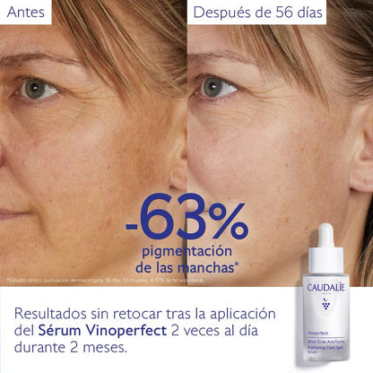 CAUDALIE™ ⭐⭐⭐⭐⭐ELIMINA LAS MANCHAS Y ACNE DE LA PIEL