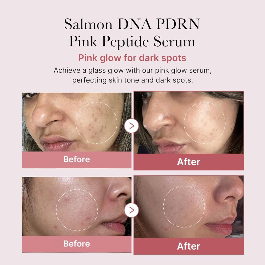 PINK SERUMS™ ⭐⭐⭐⭐⭐Elimina el acné y líneas de expresión