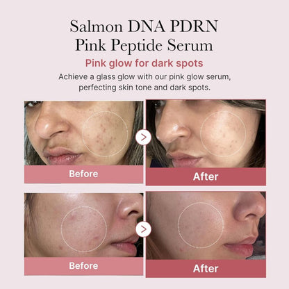 PINK SERUMS™ ⭐⭐⭐⭐⭐Elimina el acné y líneas de expresión
